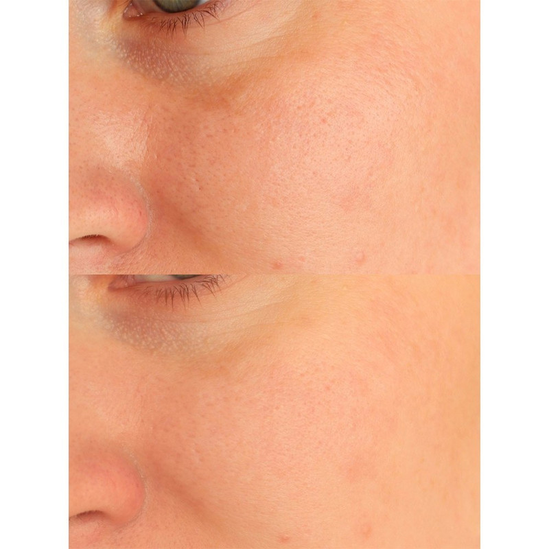 ژل فوم شستشو صورت روشن کننده سانتلا مدل ماداگاسکار مناسب برای پوست های معمولی حجم 125 میلی لیتر