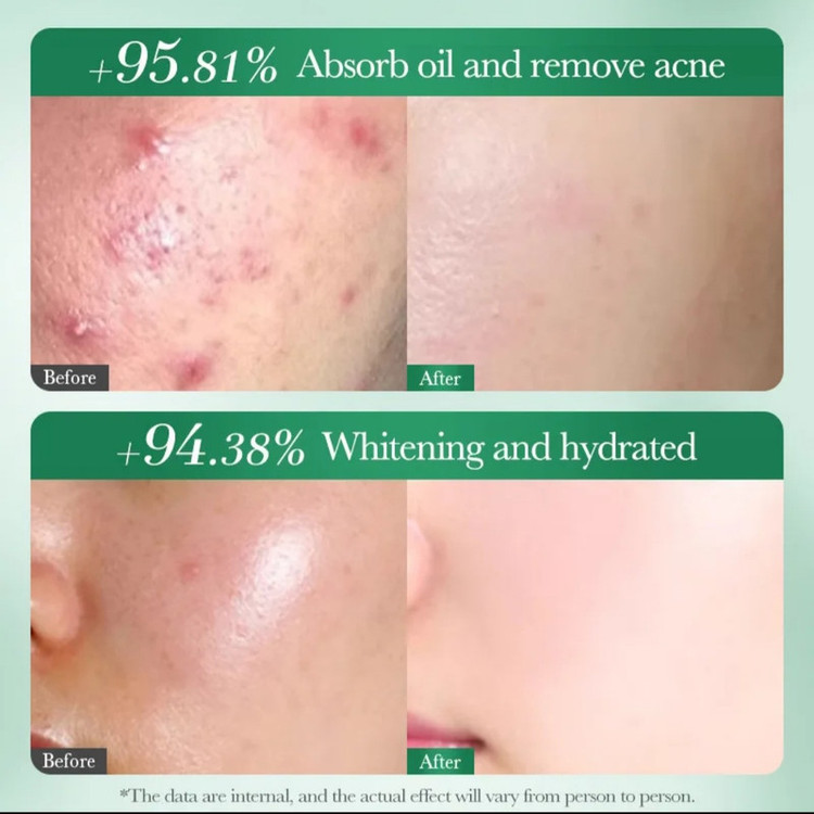 فوم ضد جوش صورت سادور مدل ANTI-ACNE مناسب برای پوست آکنهای وزن 100 گرم