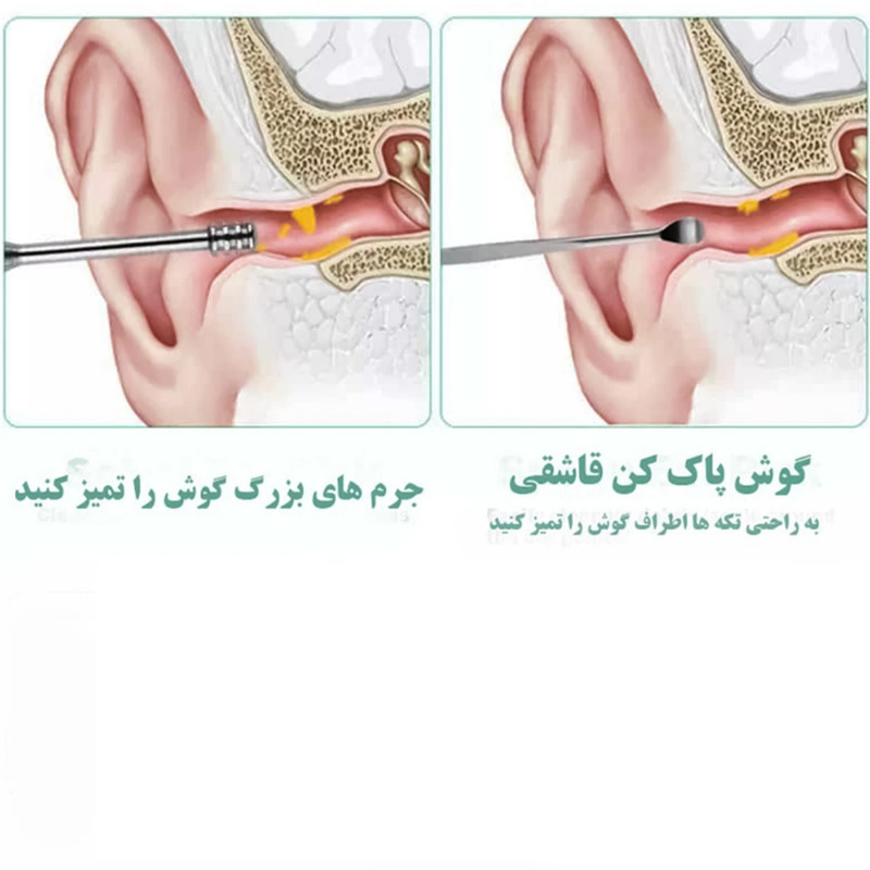 مجموعه نظافت گوش مدل Ear Care-02 بسته 6 عددی